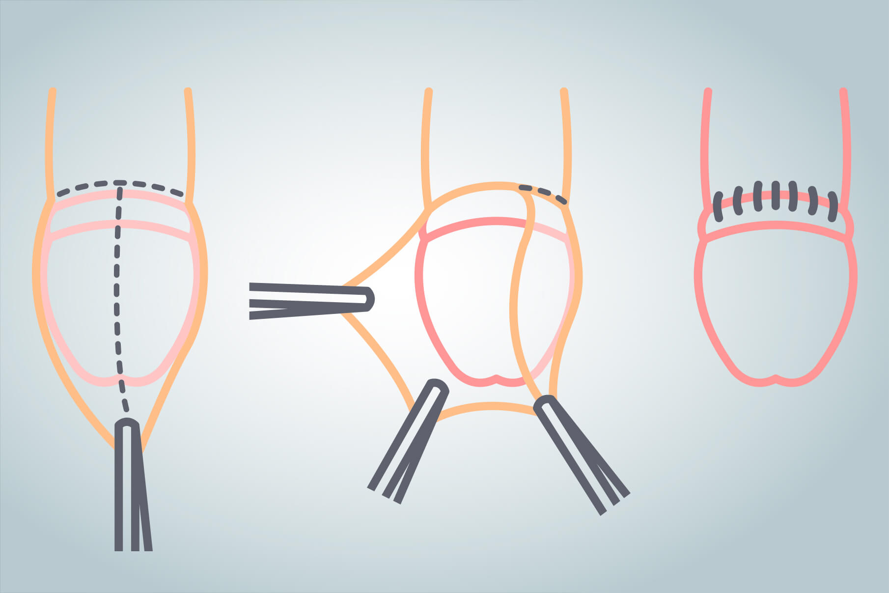 CUIVAN Clínica de Urología Integral de Vanguardia